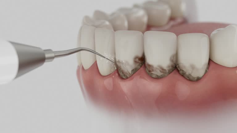 Reliable Dental contractor in Westminster, LA by Smile Center Dentistry